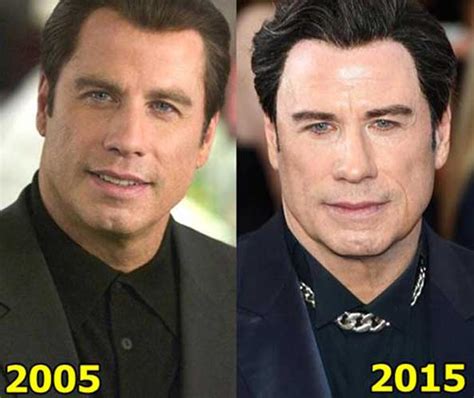 john travolta face lift|John Travolta’s Botox and Facelift